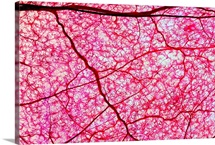 Colon blood vessels, light micrograph