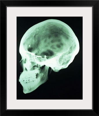 x-ray of head