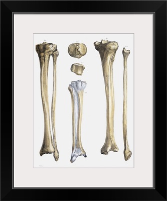 Lower leg bones and ligaments