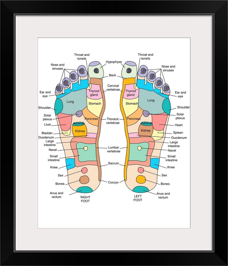 Reflexology foot map, artwork. Reflexology is a form of alternative medicine in which disorders in the body are treated by...