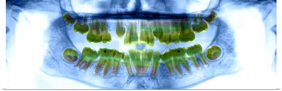 Dental X-ray