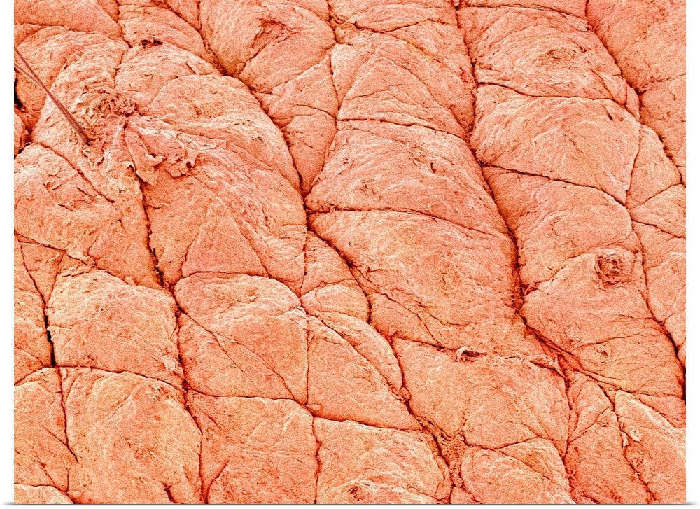 Human skin at a magnification of x40.