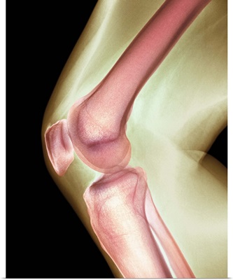 Normal knee, X-ray