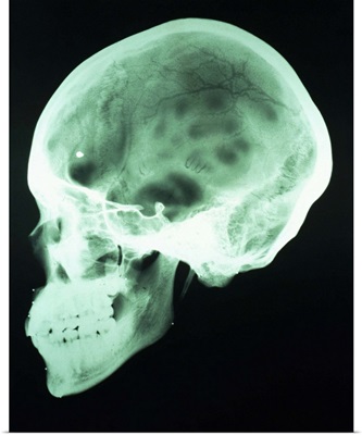 x-ray of head
