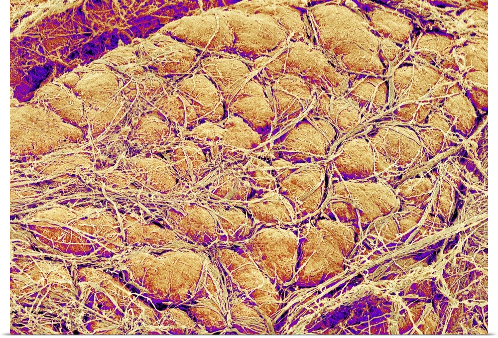 Abdominal fat tissue, coloured scanning electron micrograph (SEM). Strands of connective tissue are seen running across th...