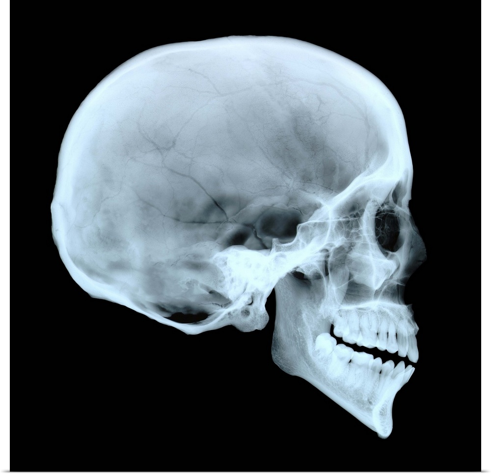 Adult human skull. Side view X-ray showing the cranium, eye socket, nasal area and teeth. For an X-ray of a baby's skull s...