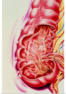 Artwork of nematode worms Ascaris sp. in intestine