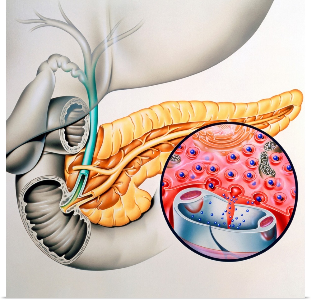 Insulin production. Artwork of the human pancreas showing production of the hormone insulin. The pancreas (yellow) is a ta...