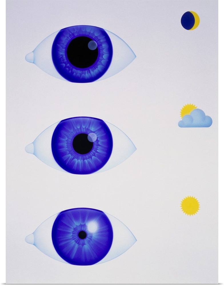 Pupil of eye. Artwork showing how the pupil of the eye reacts in three different light intensities. The pupil is the circu...