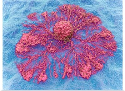 Cancer Cell Spreading, Illustration