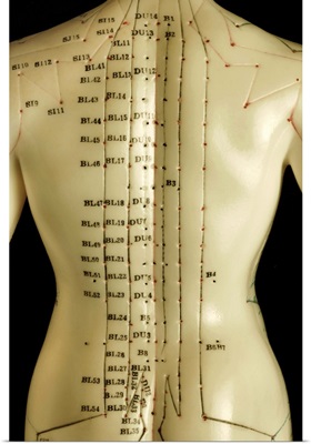 Chinese acupuncture model