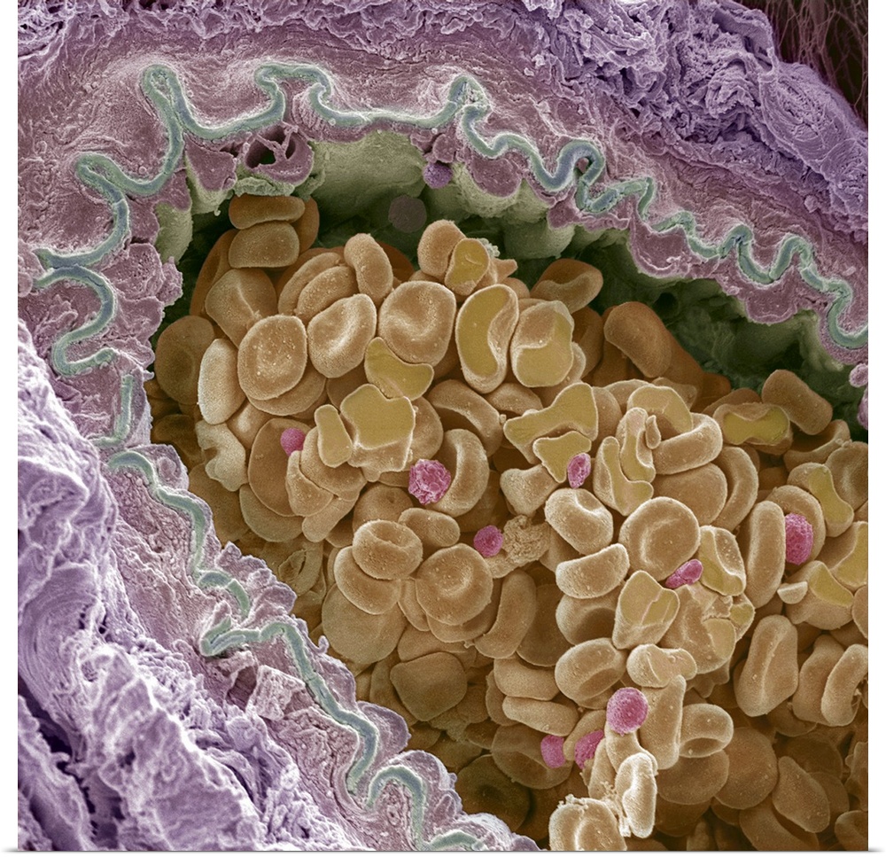 Elastic artery cross-section, coloured scanning electron micrograph (SEM). This section is through a small elastic artery ...