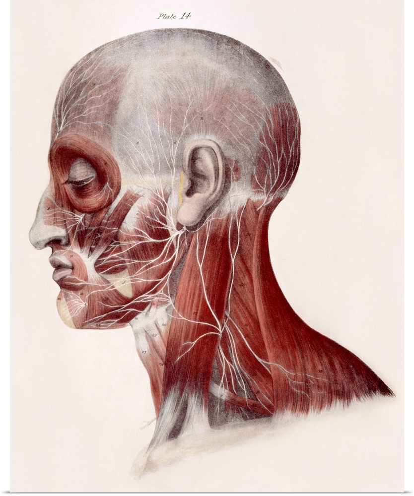 Facial nerves. Historical anatomical artwork of a side view of a dissected human head showing the nerves (white) and muscl...