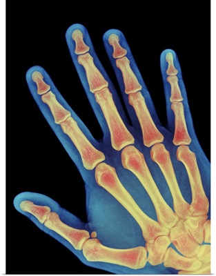 Healthy adult hand, X-ray