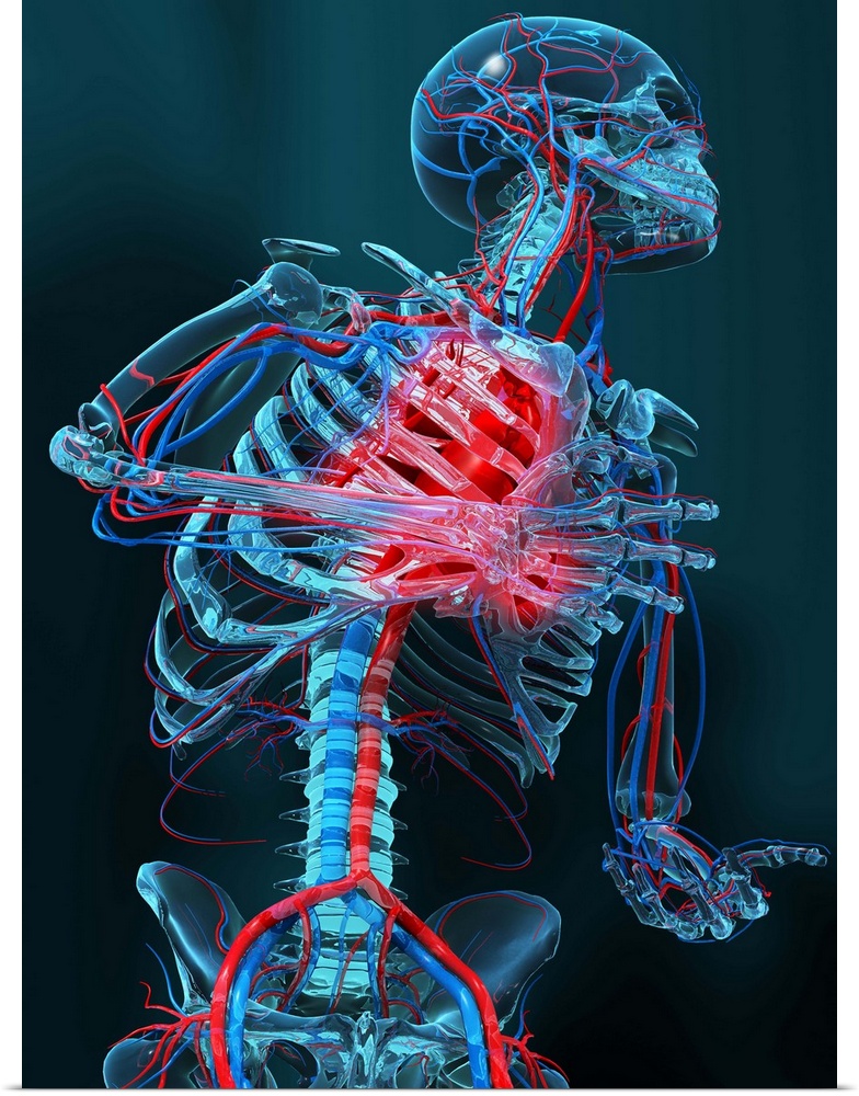 Heart attack. Computer artwork of the head and body of a human skeleton that is having a heart attack (myocardial infarcti...