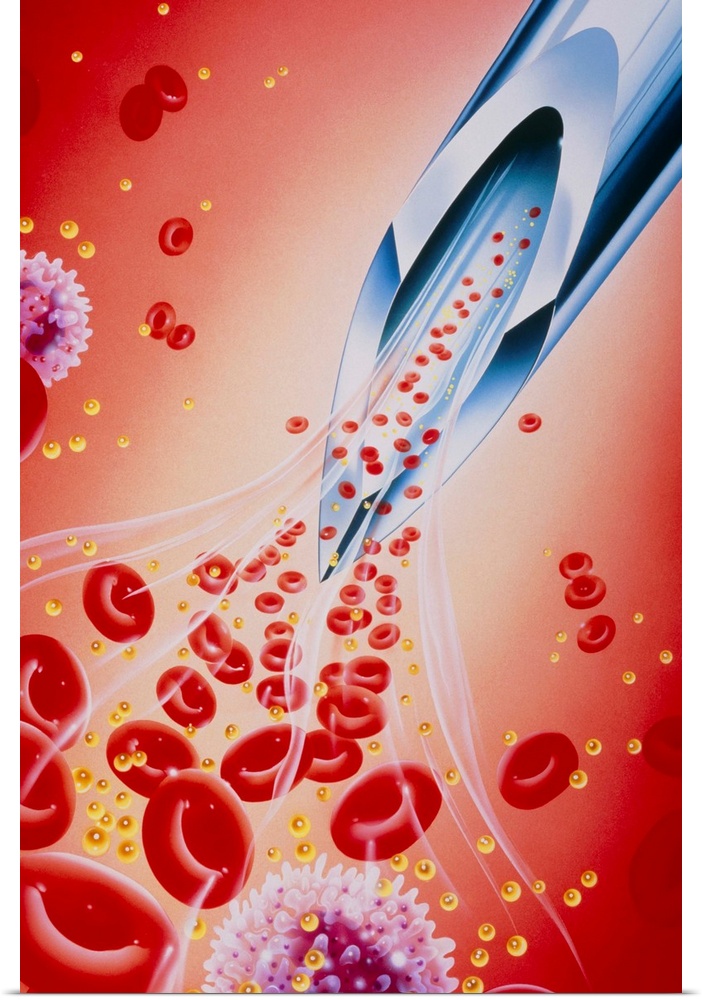 Illustration of a syringe needle sampling blood products, including the low-density lipoprotein (LDL) particle, a form of ...