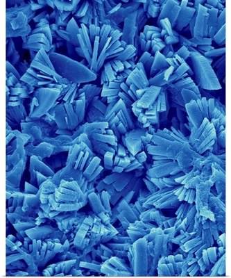 Kidney Stone Monoclinic Crystals, SEM