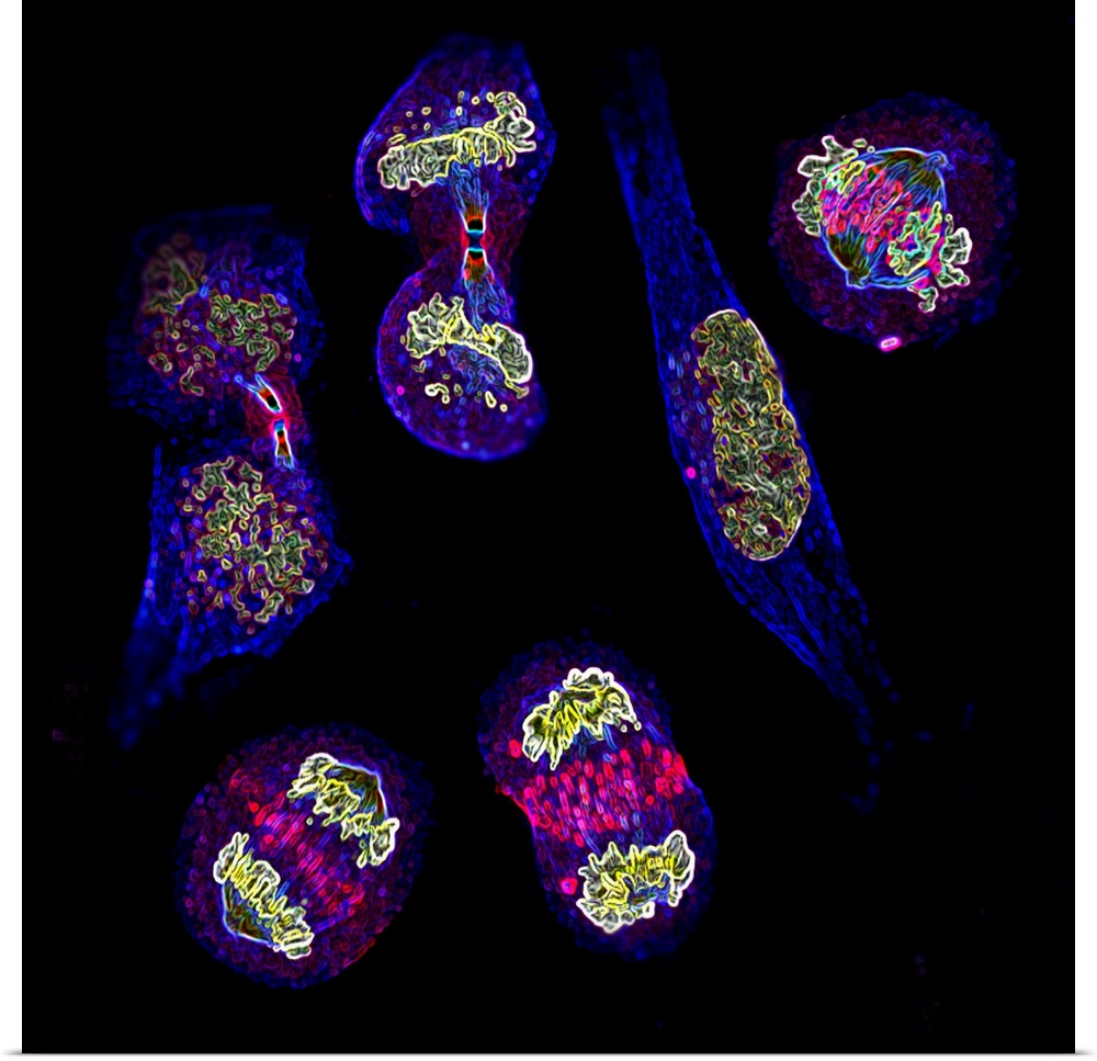 Mitosis. Fluorescence micrograph of six cells at different stages of mitosis (nuclear division). Mitosis is the formation ...