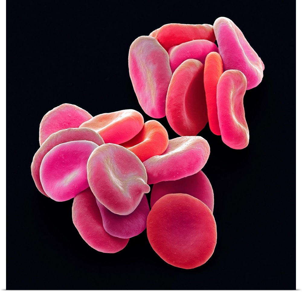 Red blood cells. Coloured scanning electron micrograph (SEM) of red blood cells (RBCs, erythrocytes). Red blood cells are ...