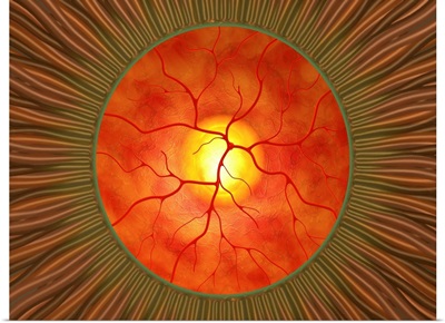 Retina in glaucoma, artwork