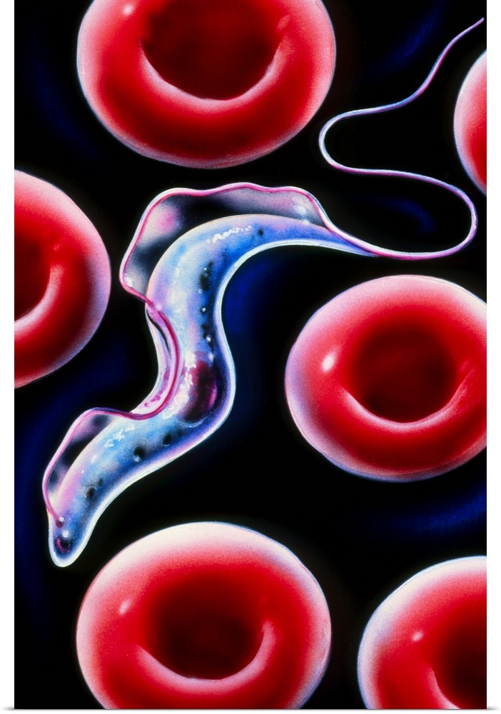 Sleeping sickness. Artwork of a trypanosome (Trypanosoma brucei) moving past human red blood cells in the blood. This prot...