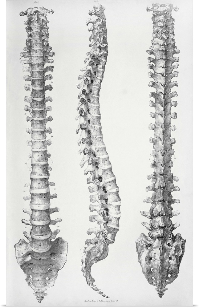 Spine anatomy. Historical anatomical artwork of the spine (backbone) seen from the front (left), side (middle) and rear (r...
