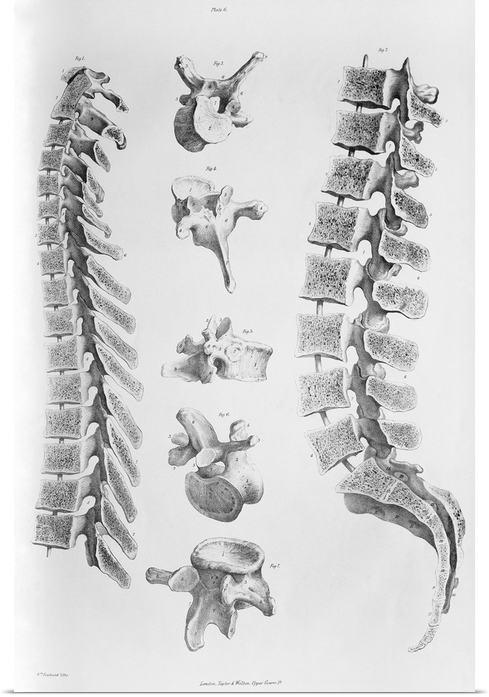 Spine anatomy. Historical anatomical artwork of a section through the spine (backbone) seen from the side (rear of spine a...