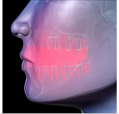 Toothache, conceptual artwork