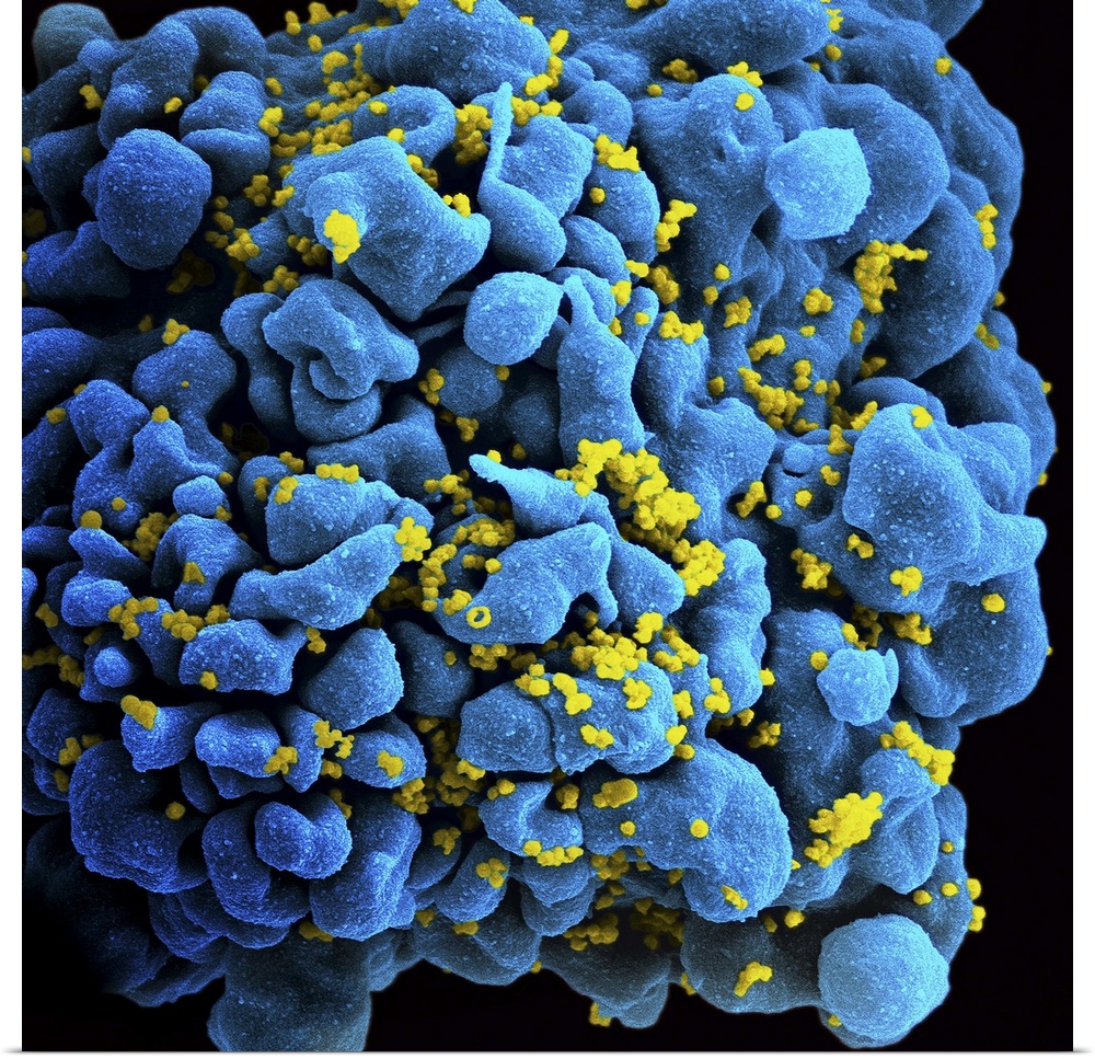 Colorized image of HIV-infected H9 T-cell.