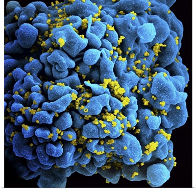 Colorized image of HIV-infected H9 T-cell