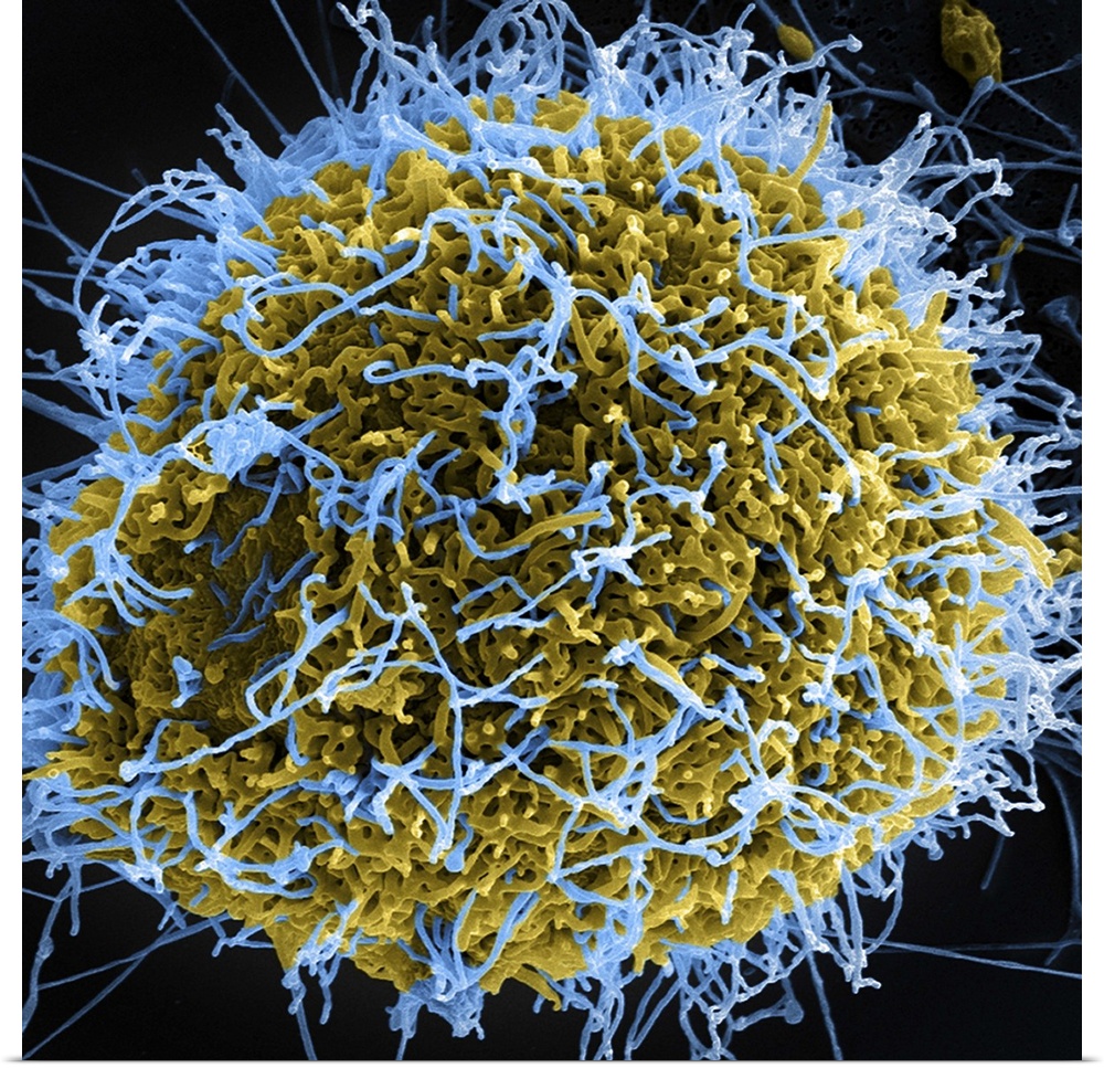Colorized scanning electron micrograph of filamentous Ebola virus particles (blue) budding from a chronically infected VER...