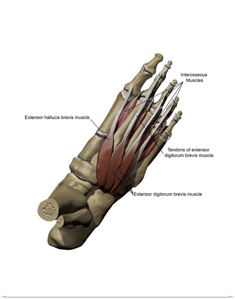 Human foot showing the dorsal intermediate muscles and bone structures with annotations.