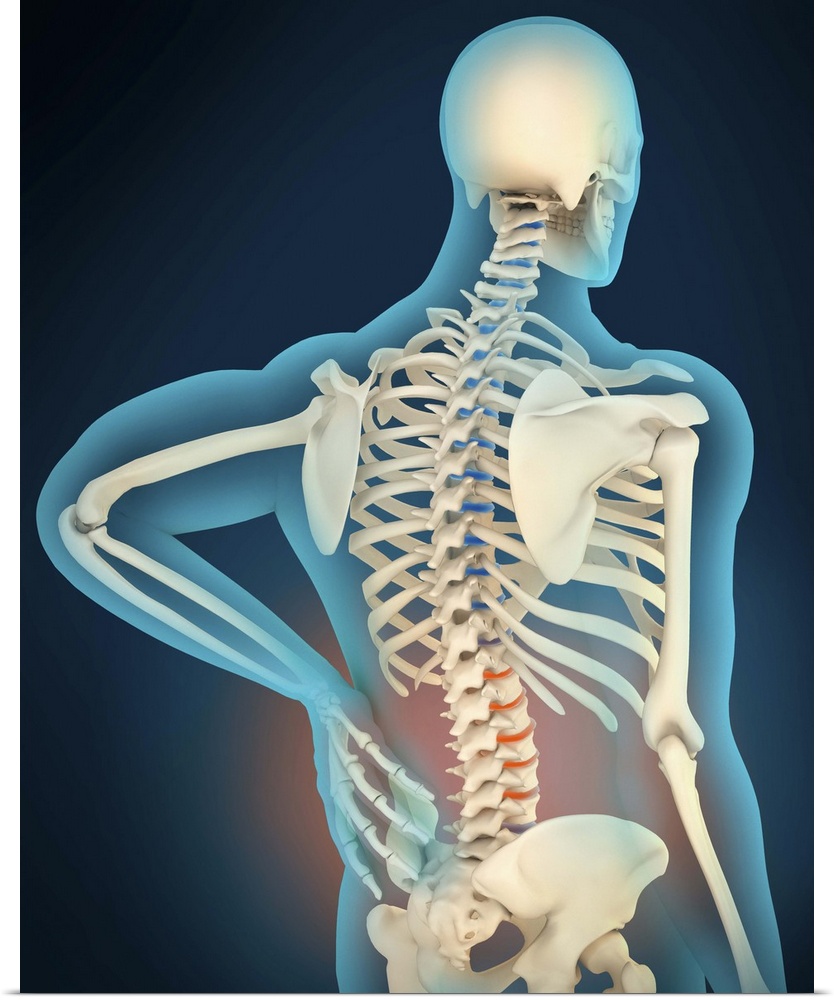 Medical illustration showing inflammation and pain in human back area, perspective view.