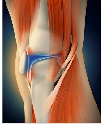 Medical illustration showing inflammation in human knee joint