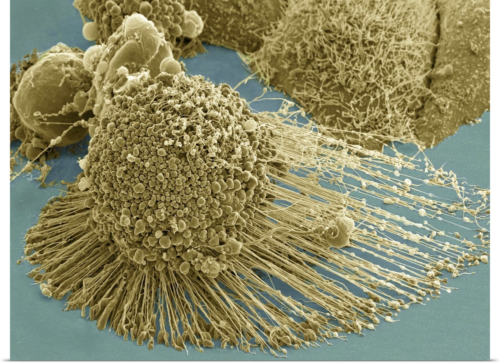 Scanning electron micrograph of an apoptotic HeLa cell. Zeiss Merlin HR-SEM.
