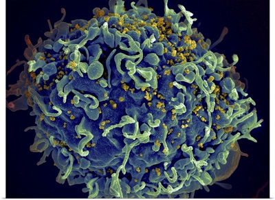 Scanning electron micrograph of HIV particles infecting a human H9 T cell