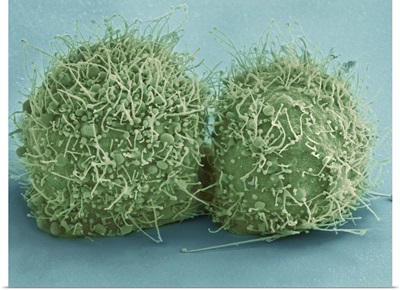 Scanning electron micrograph of just-divided HeLa cells