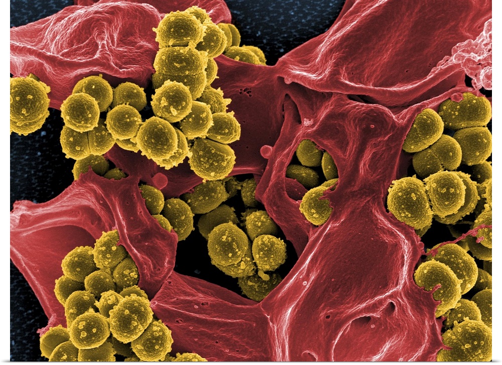 Scanning electron micrograph of methicillin-resistant Staphylococcus aureus and a dead human neutrophil..