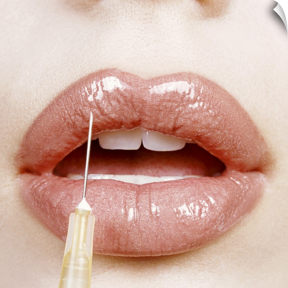 Close-up of a Woman's Lips Receiving Cosmetic Surgery from a Syringe