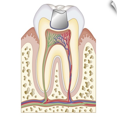 Cross section biomedical illustrationBiomedical illustration of dental filling