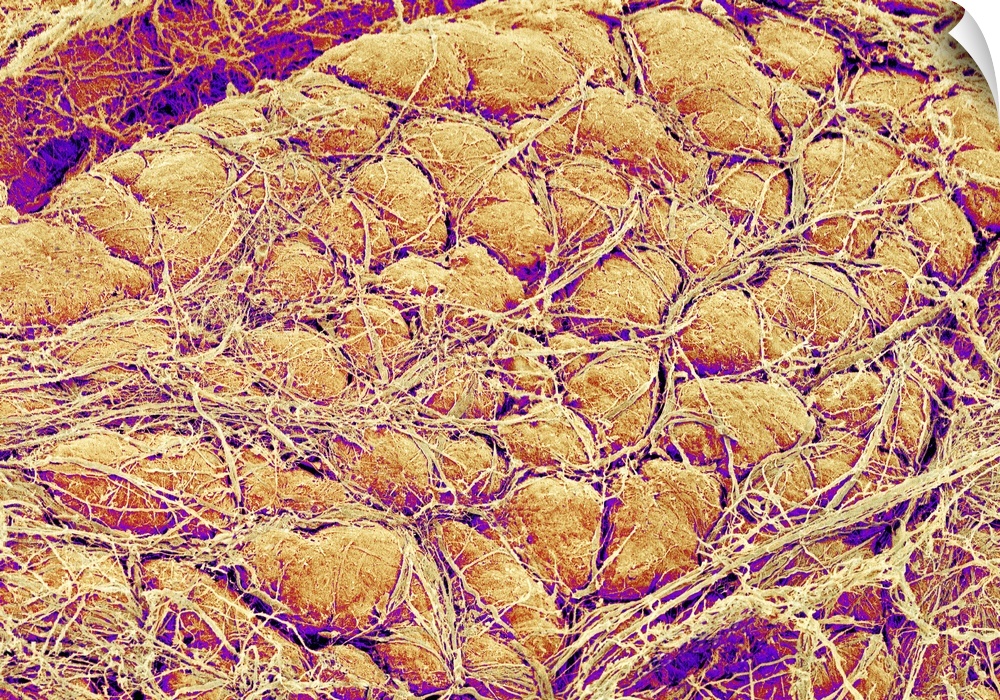 Abdominal fat tissue, coloured scanning electron micrograph (SEM). Strands of connective tissue are seen running across th...