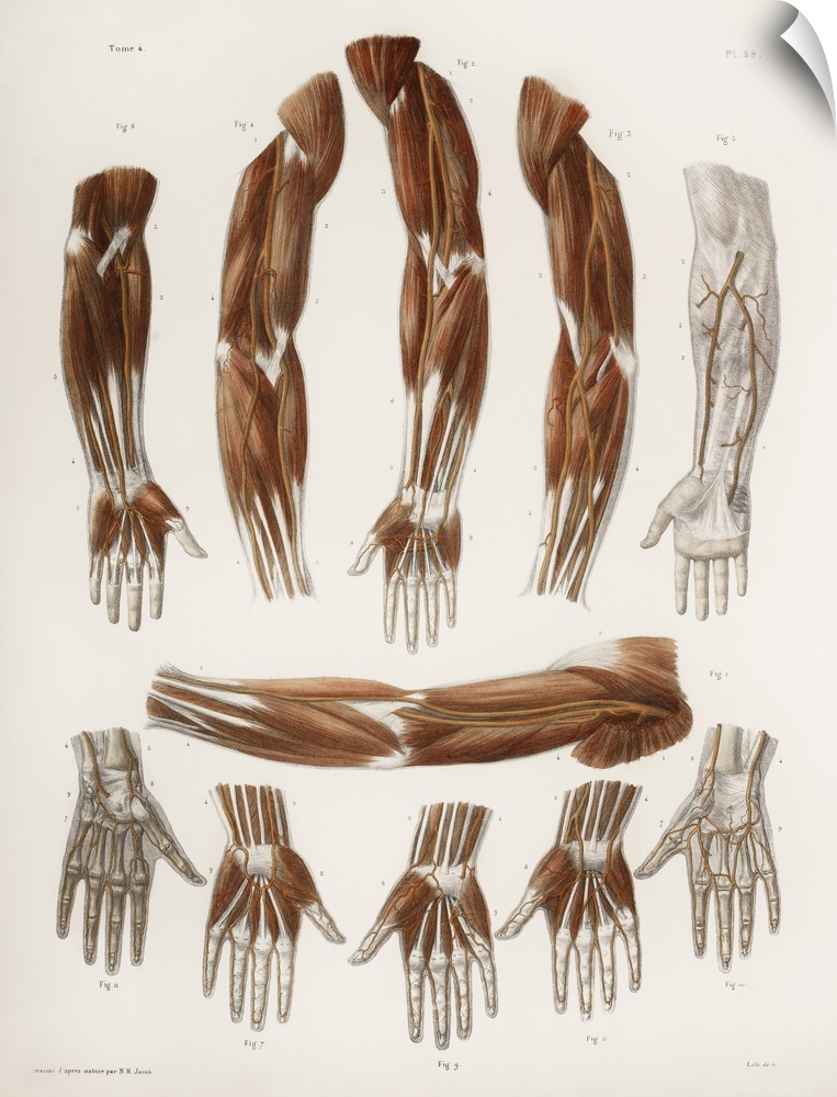 Arm anatomy, historical artwork. 19th Century hand coloured lithographic print showing some common differences in the loca...