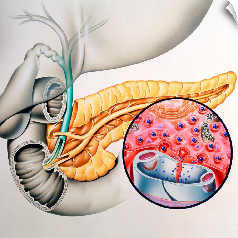 Insulin production. Artwork of the human pancreas showing production of the hormone insulin. The pancreas (yellow) is a ta...