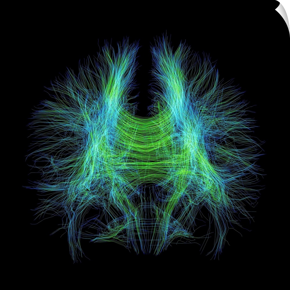 Brain fibres. 3D diffusion tensor imaging (DTI) magnetic resonance imaging (MRI) scan of nerve pathways in the brain. The ...