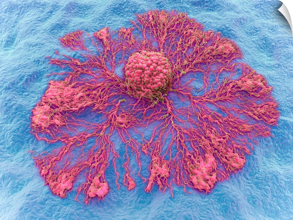 Cancer cell spreading. Three-dimensional computer illustration of a cancer cell spreading.
