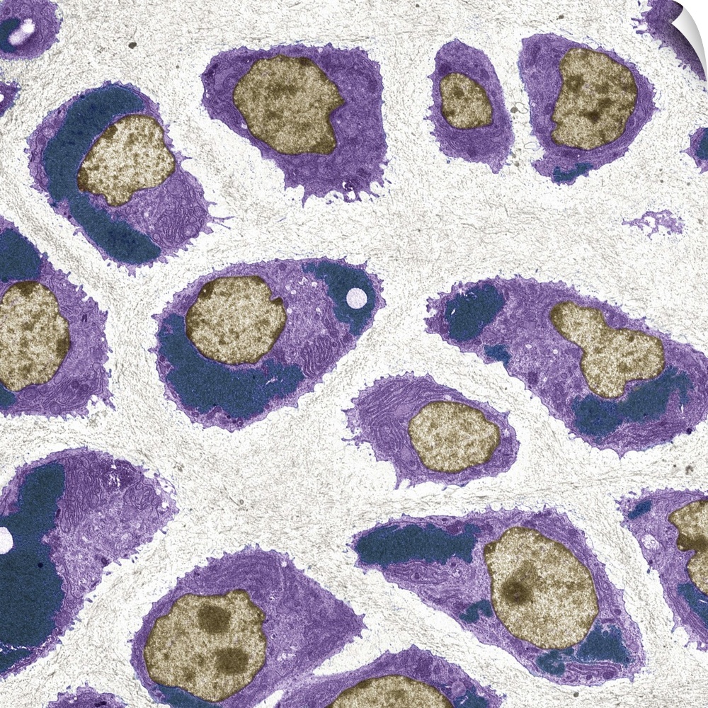 Cartilage cells. Coloured transmission electron micrograph (TEM) of a section through chondrocytes from nasal hyaline cart...