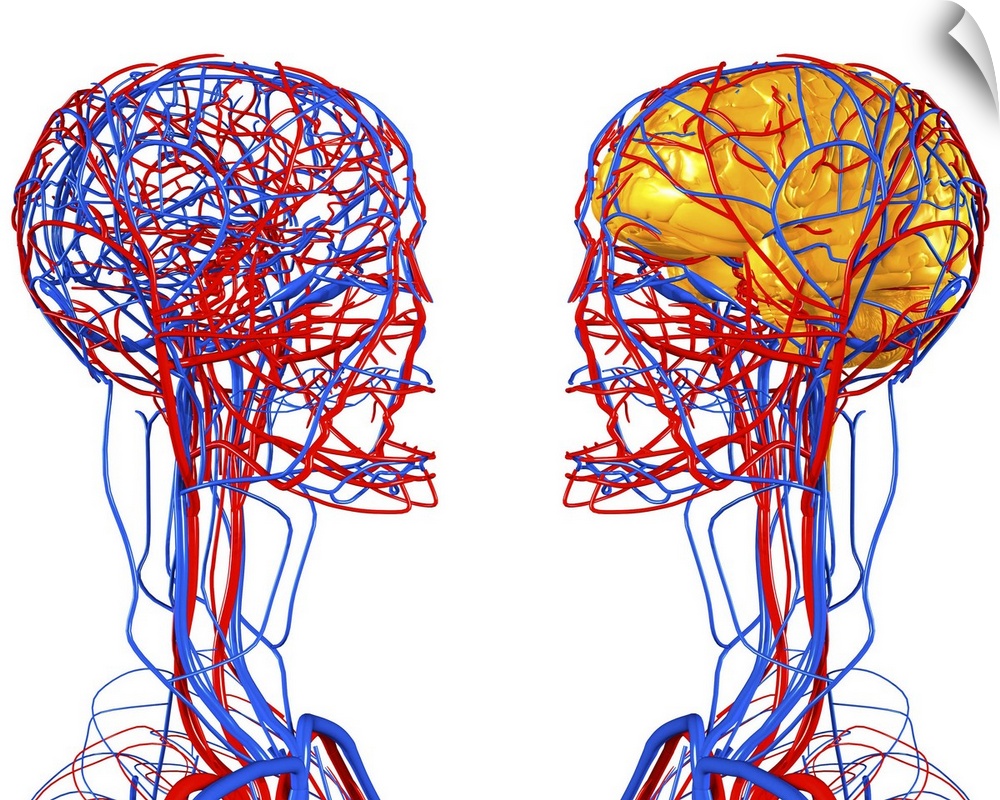 Circulatory system and brain. Computer artwork showing the blood vessels of the head and neck. Also seen is the brain (yel...