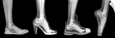 Different Shoes X-Ray