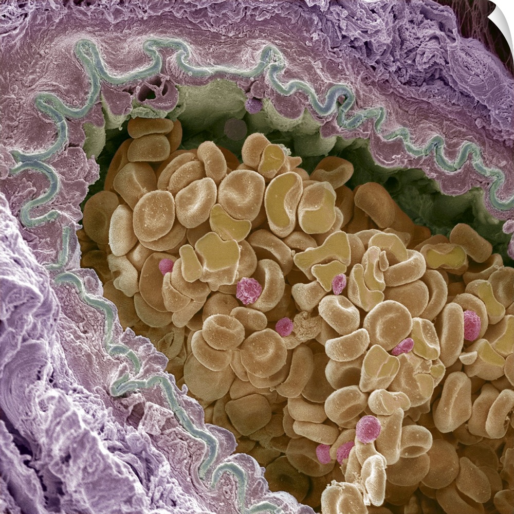 Elastic artery cross-section, coloured scanning electron micrograph (SEM). This section is through a small elastic artery ...