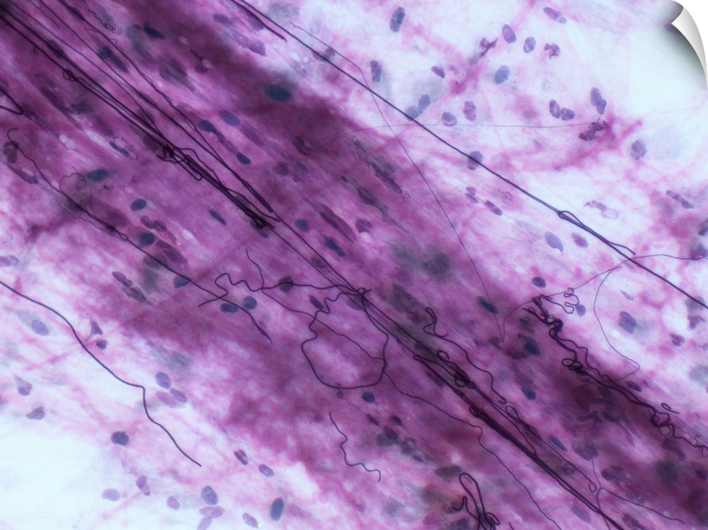 Light micrograph (LM) of loose connective tissue to show elastin fibers. Elastin fibres form a 3D network with collagen fi...